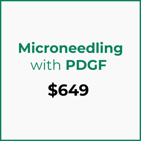 ANNIVERSARY PROMO: MICRONEEDLING with PDGF