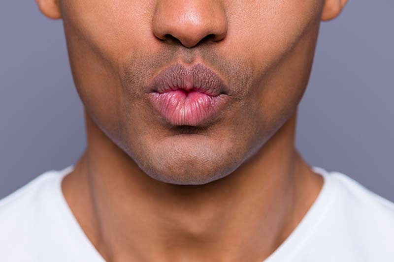 The results of lip filler for men.