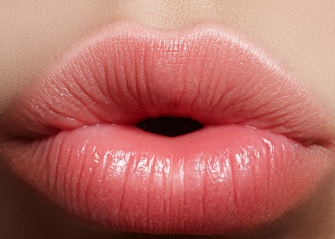 Botox Lip Flip Explained 10 Things You Need to Know