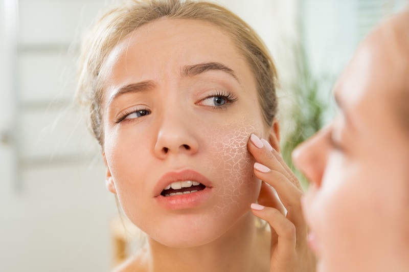 One of Omega 3 benefits for the skin is protection of dry skin