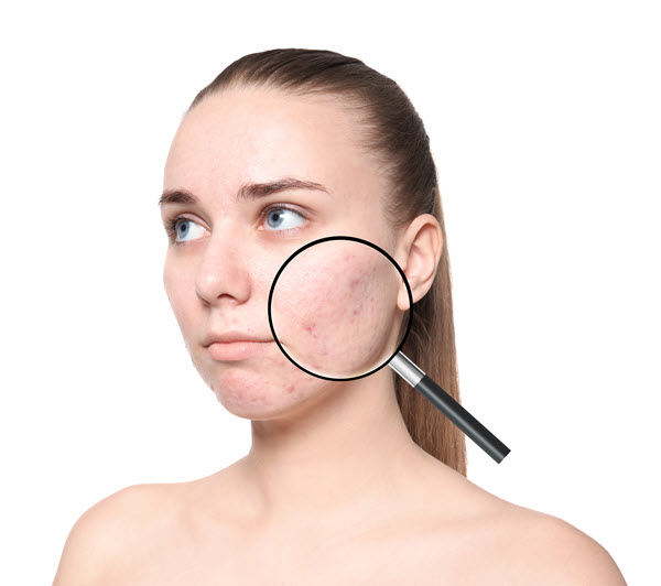 Diagnosing skin inflammation.