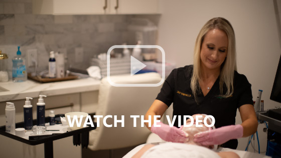 Video of Jalair Whitman giving a chemical peel to a client