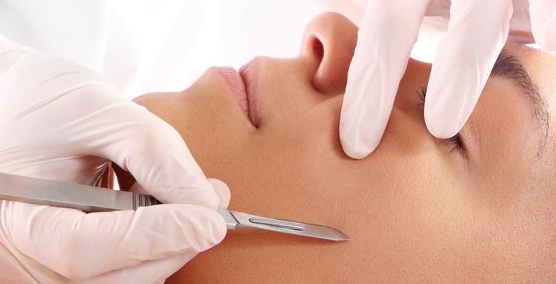 What is dermaplaning and is it safe?