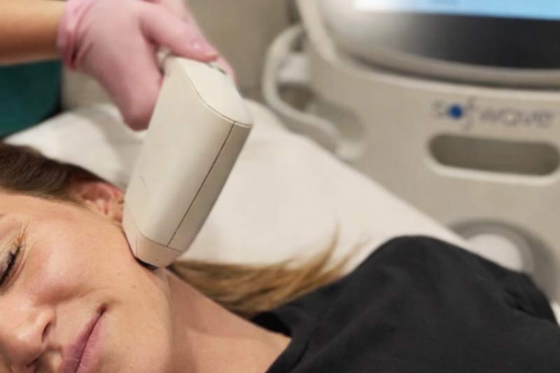 How Long Does Sofwave Last?