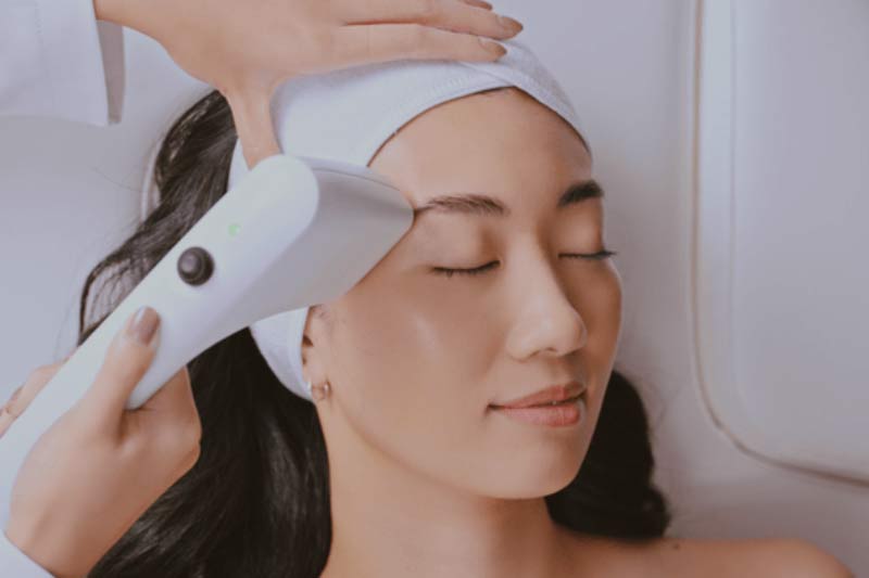 Sofwave Brow Lift: Things to Know