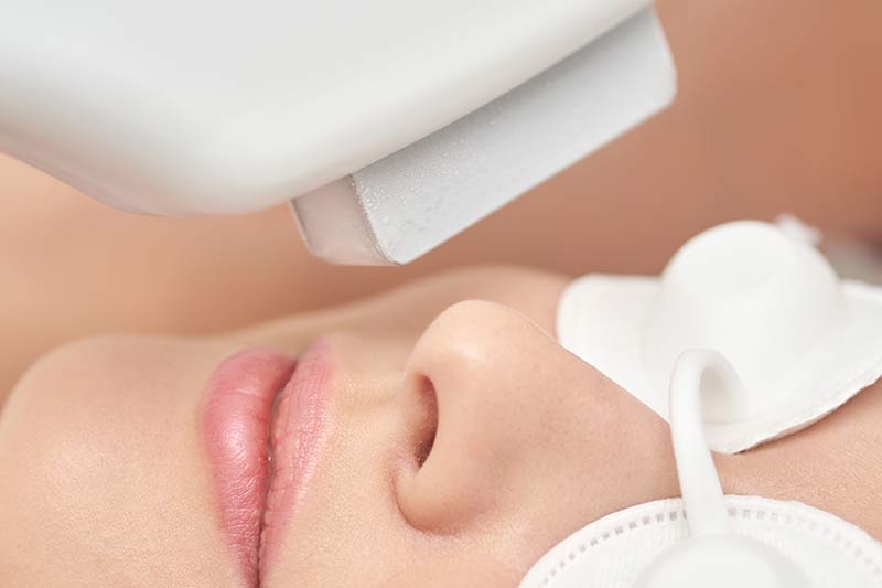 Sofwave Under the Eyes: Things to Know