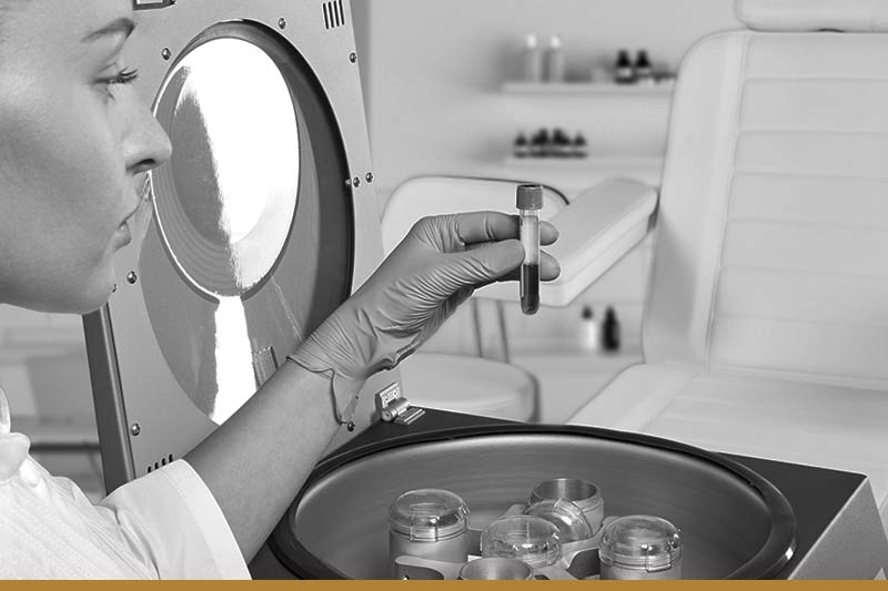 What is total testosterone test?