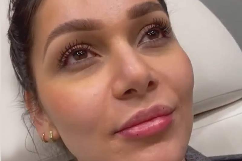 Results after the Skinvive treatment