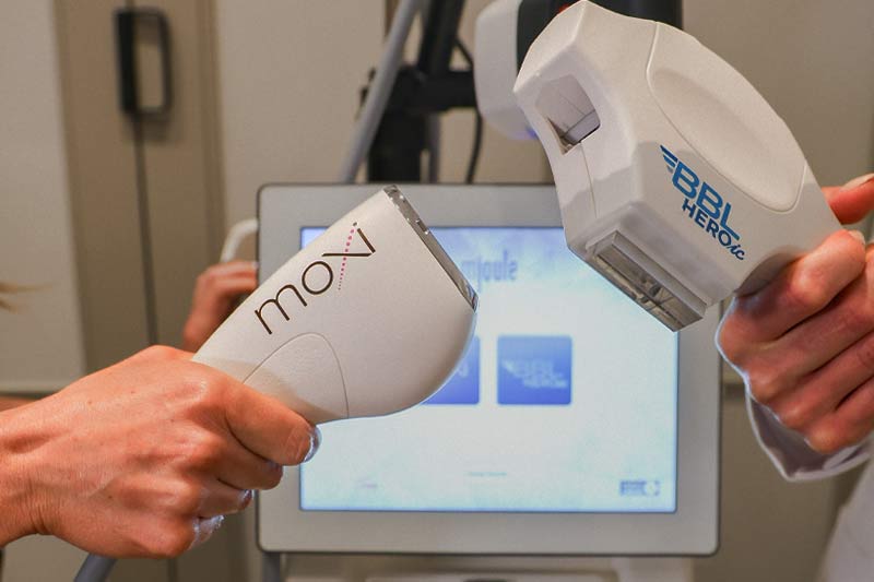 BBL vs. MOXI Laser: What Are Their Differences?