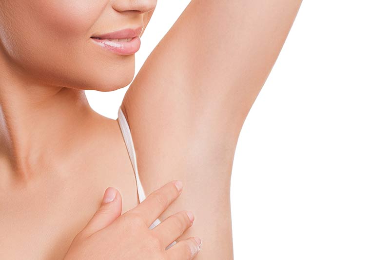 Results of Botox in the armpits