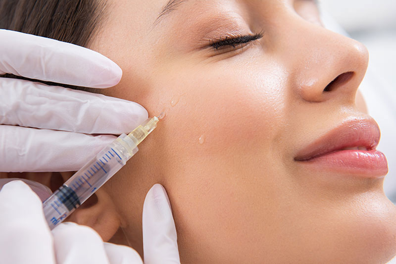 How to prevent bruising after cheek filler