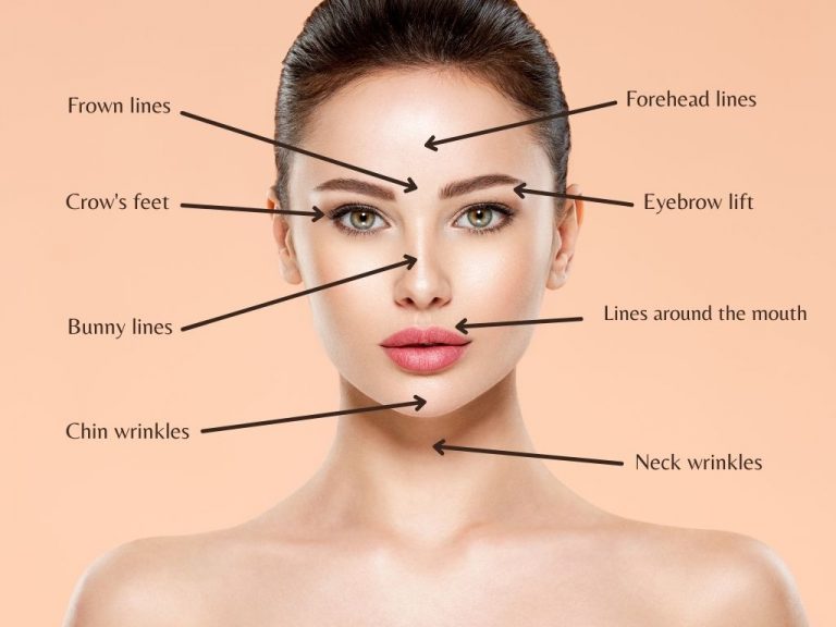 Botox Areas: 8 Common Injection Sites