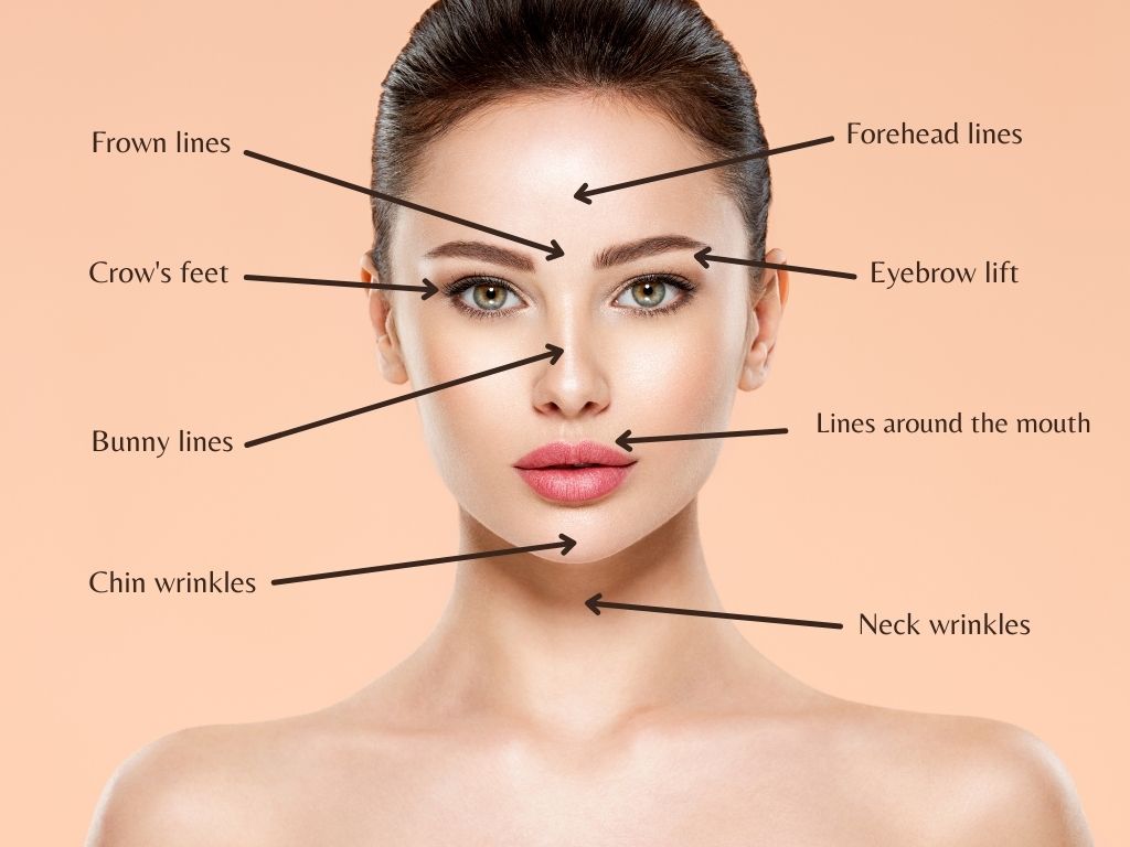 common-botox-areas-that-can-be-treated-8-areas