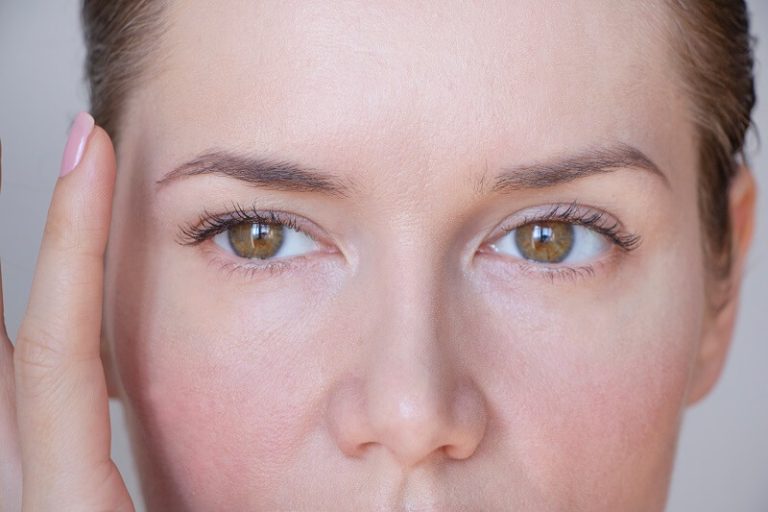 droopy-eyelid-after-botox-why-it-happens-and-how-to-fix-it