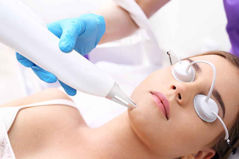 Laser resurfacing for skin rejuvenation