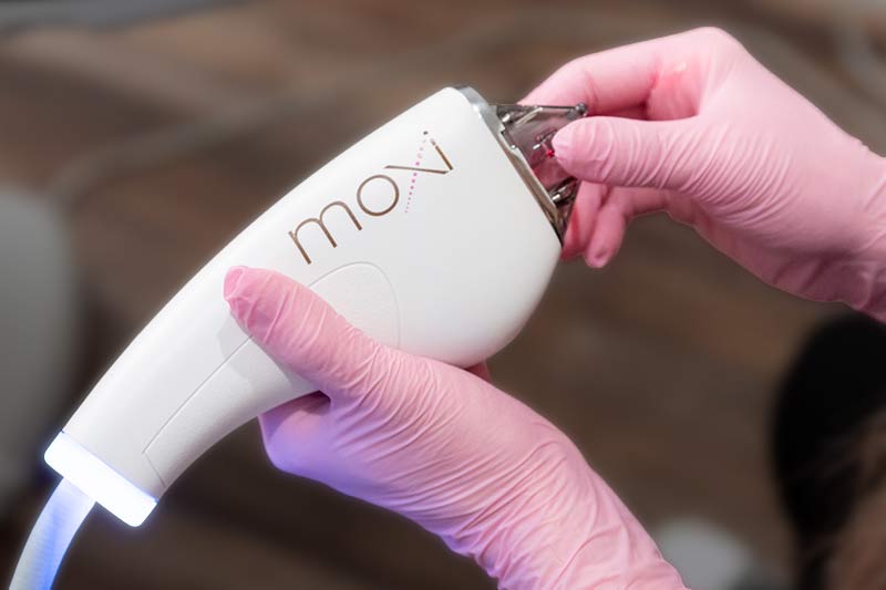 How much does MOXI laser cost?