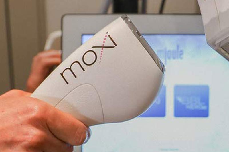 MOXI laser treatment