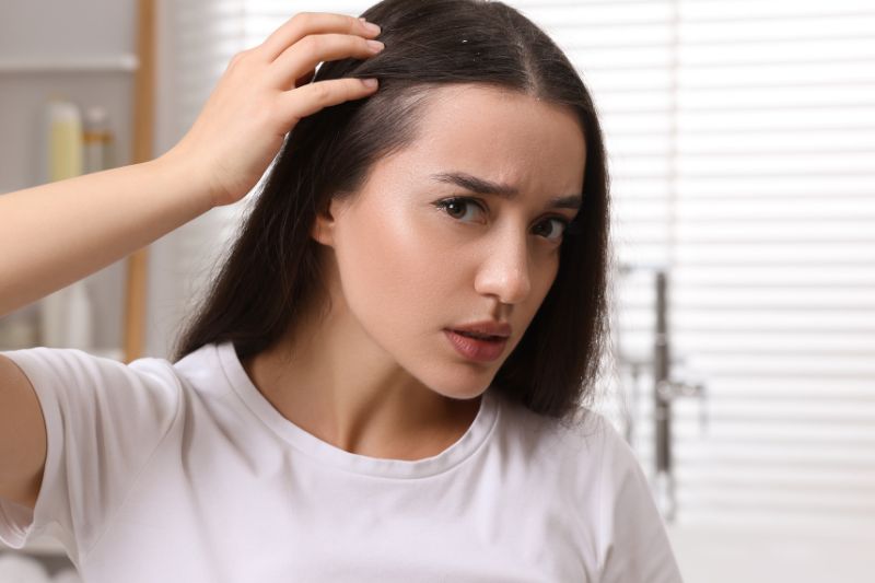 Psoriasis on scalp.