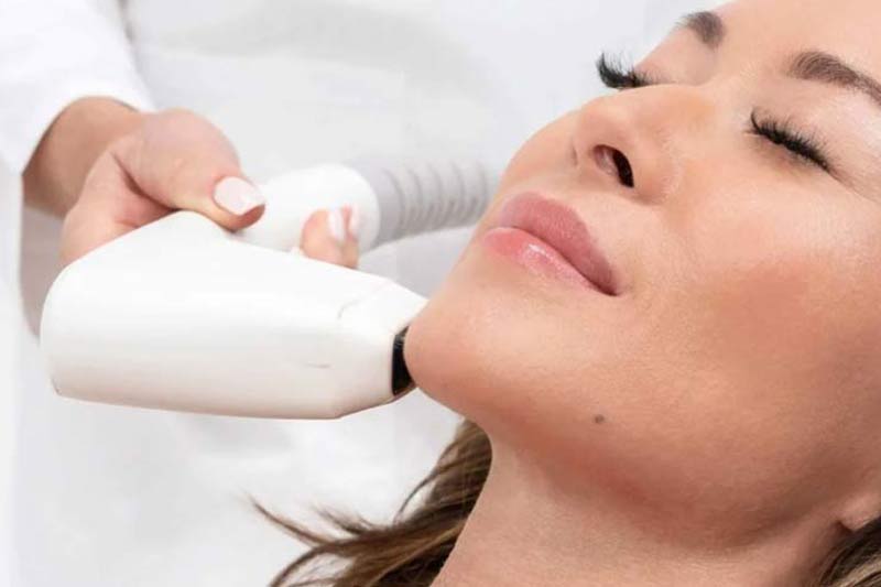 Sofwave vs. Ultherapy procedures