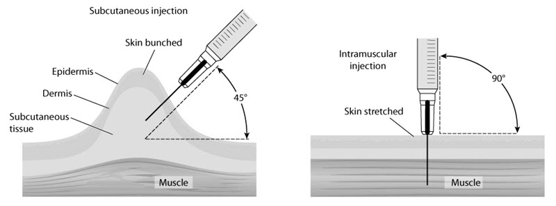 Subcutaneous vs. intramuscular vitamin b12 injection.
