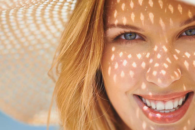 Treating sun damaged skin