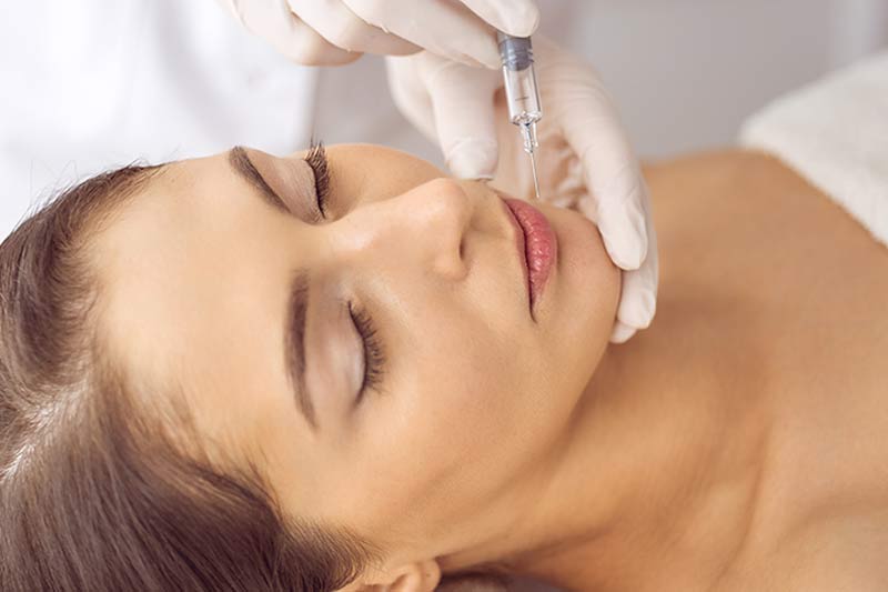 Swelling after lip filler