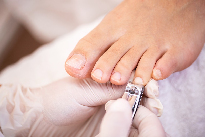 Regular nail trimming