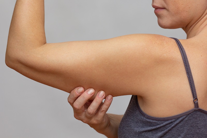 The CoolSculpting for Upper arm fat