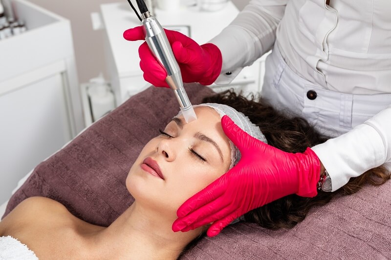 What is Microneedling?